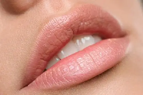 6 συμβουλές για να αποκτήσετε πιο γεμάτα χείλη